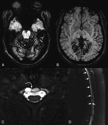 Fig 8.