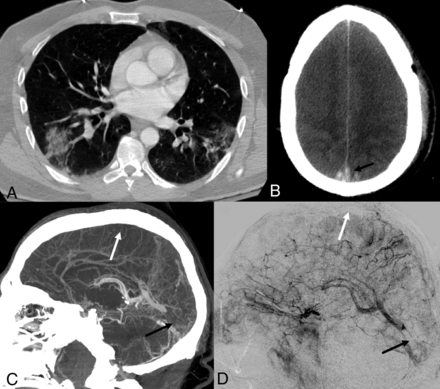 Fig 1.