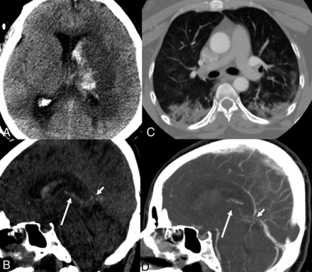 Fig 3.