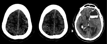 Fig 1.