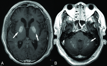 Fig 5.