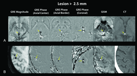 Fig 4.