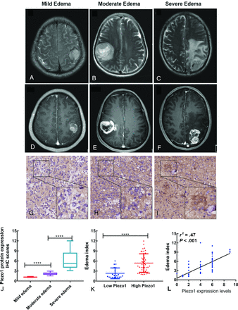 Fig 3.