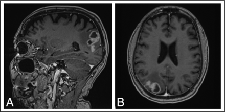 Fig 1.