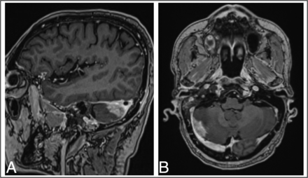 Fig 3.