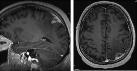Fig 4.
