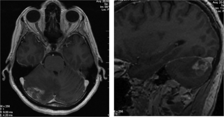 Fig 6.