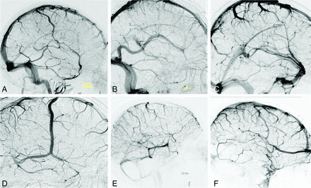 Fig 1.