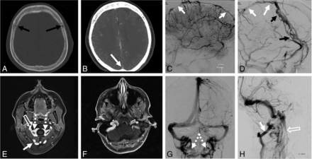 Fig 2.