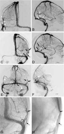 Fig 5.