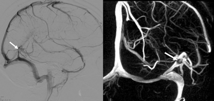Fig 6.