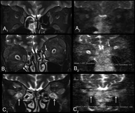 Fig 3.