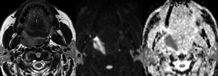 Fig 1.