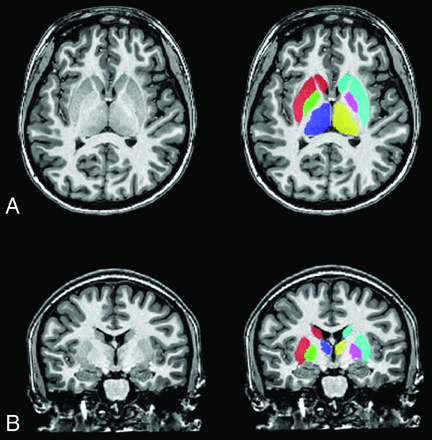 Fig 1.