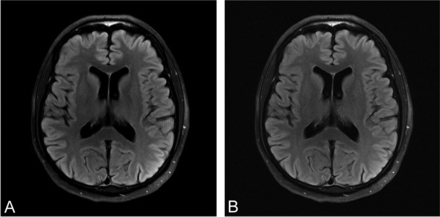 Fig 3.