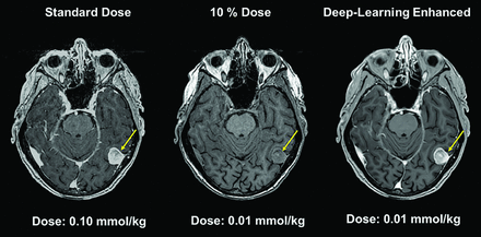 Fig 4.
