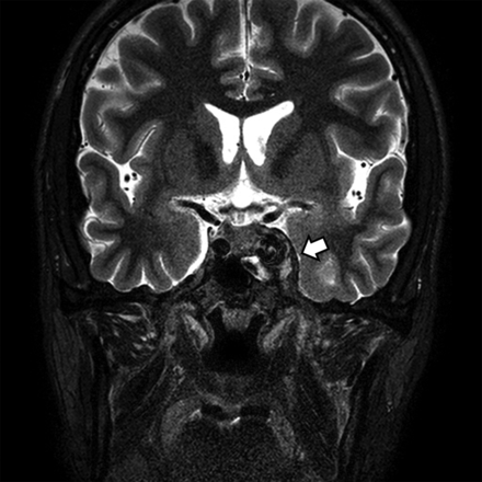 FIG 2.