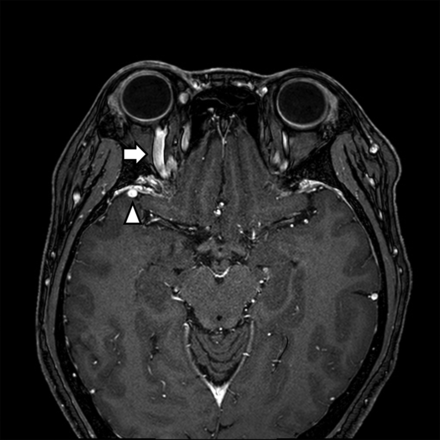 FIG 4.