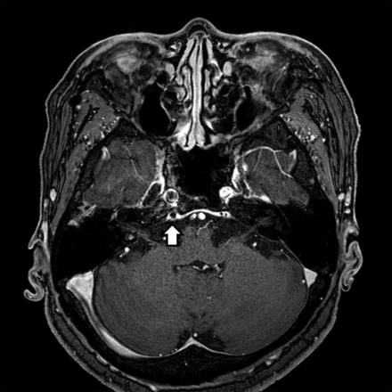 FIG 5.
