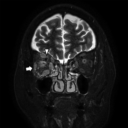 FIG 6.