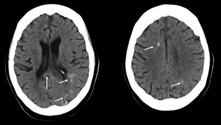 FIG 2.