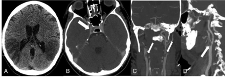 FIG 5.