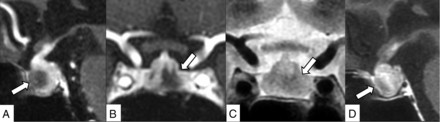 FIG 2.