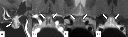 FIG 3.