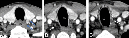 FIG 6.