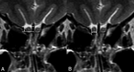 FIG 1.