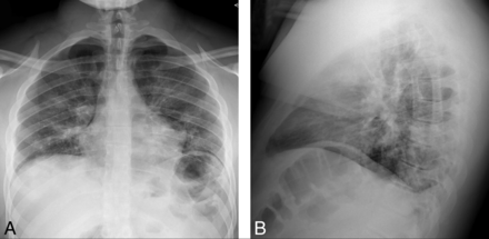 FIG 1.