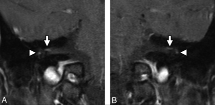 FIG 2.