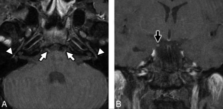 FIG 3.