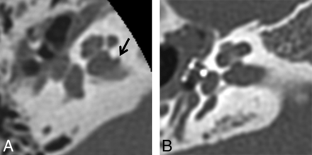FIG 1.