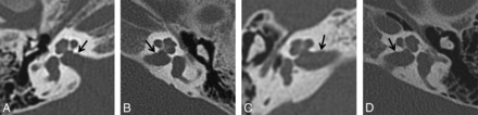 FIG 4.