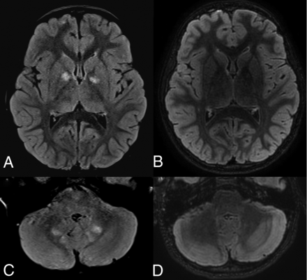 FIG 3.