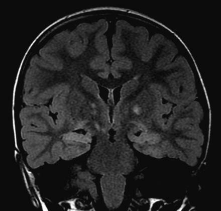 FIG 5.