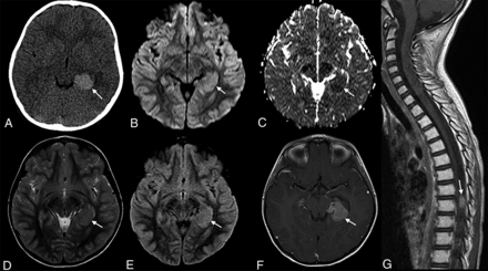 FIG 1.