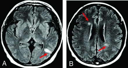 FIG 3.