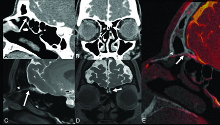 FIG 1.