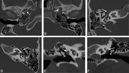 FIG 4.
