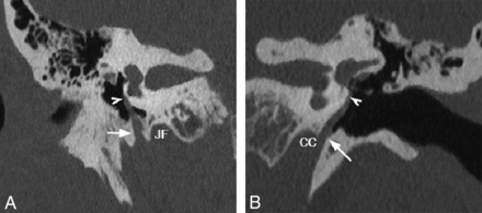 FIG 6.