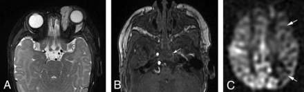 FIG 1.