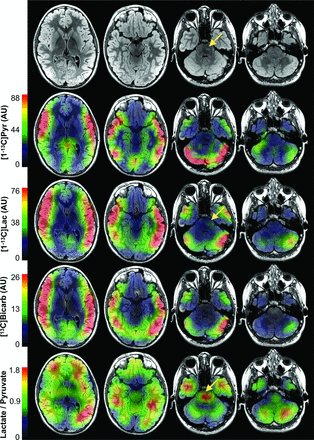 FIG 1.