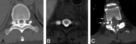 FIG 3.