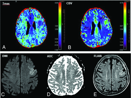 FIG 3.