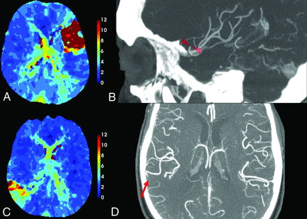 FIG 3.