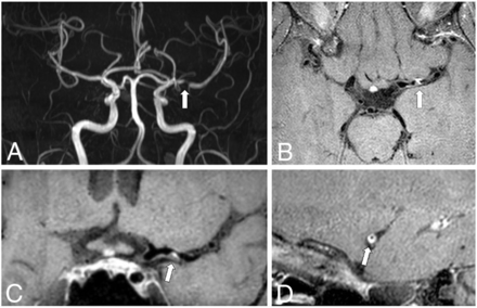 FIG 2.