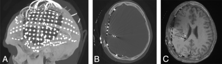 FIG 2.