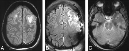 FIG 3.